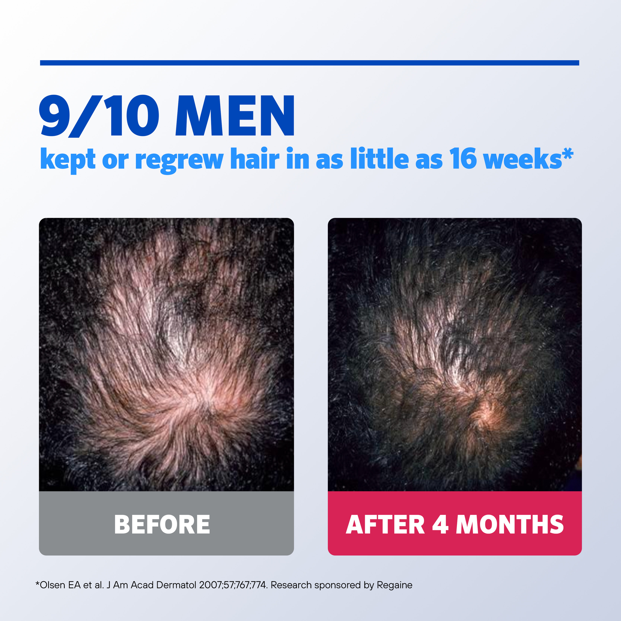 Regaine Hair Loss Treatment Mens Extra Strength 4 Months 60ml X 4 - 240ml - Image 7