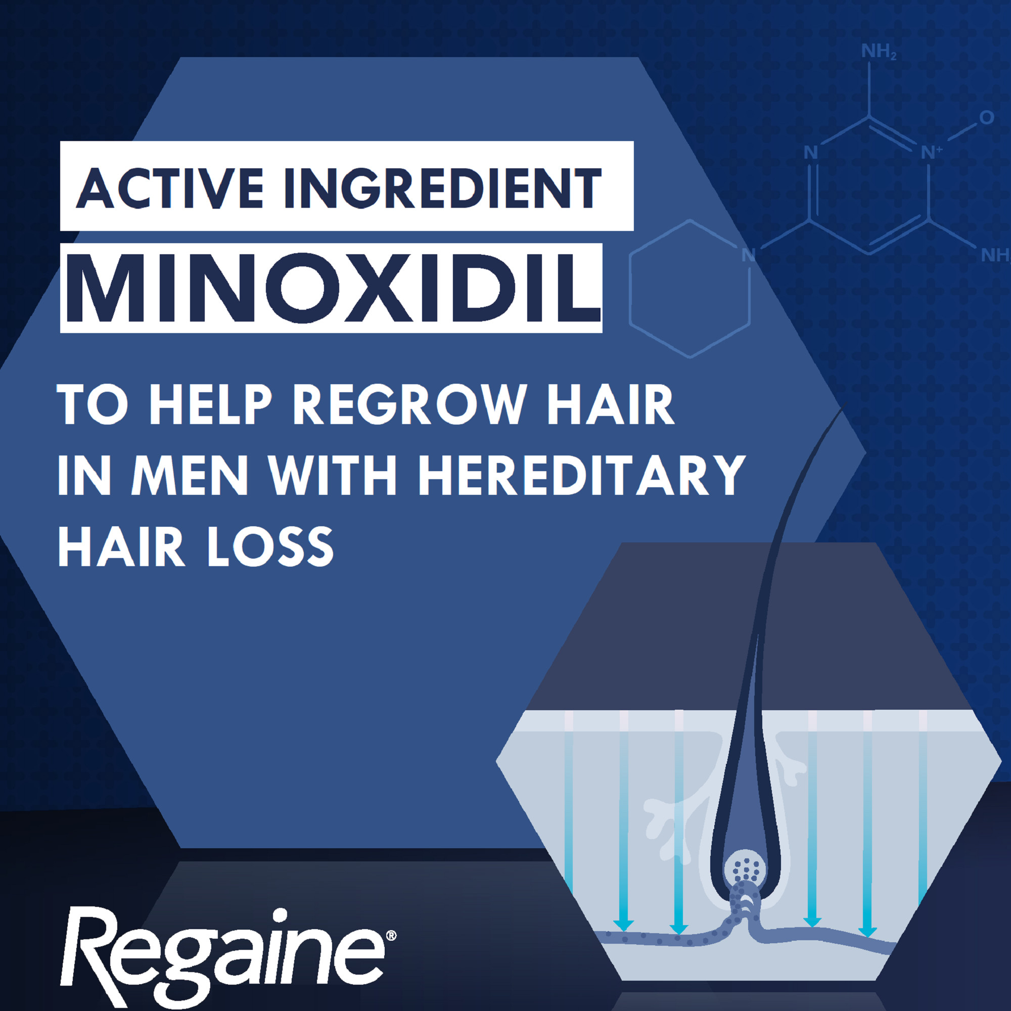 Regaine Hair Loss Treatment Mens Extra Strength 4 Months 60ml X 4 - 240ml - Image 10