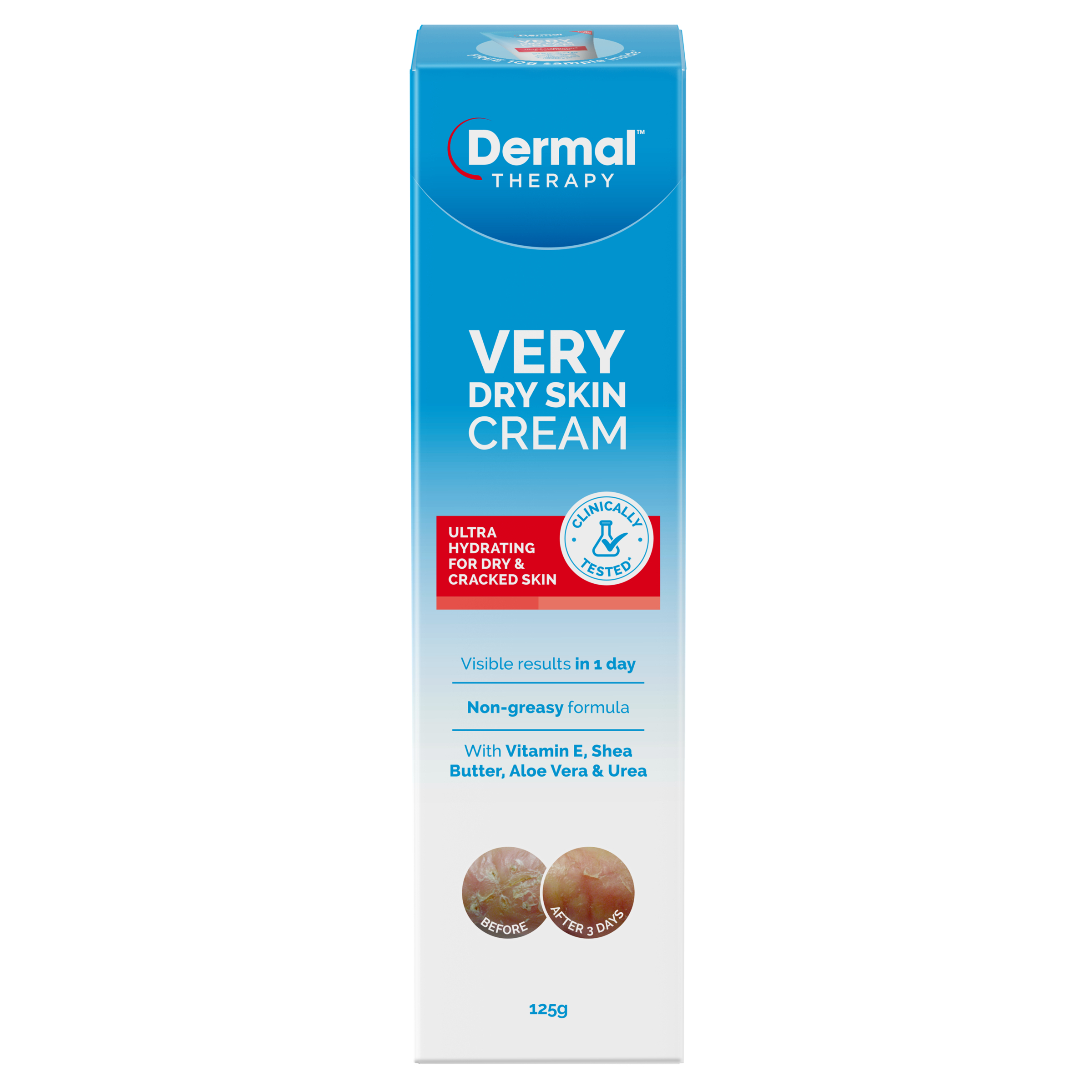 Dermal Therapy Very Dry Skin Cream 125g - Image 1