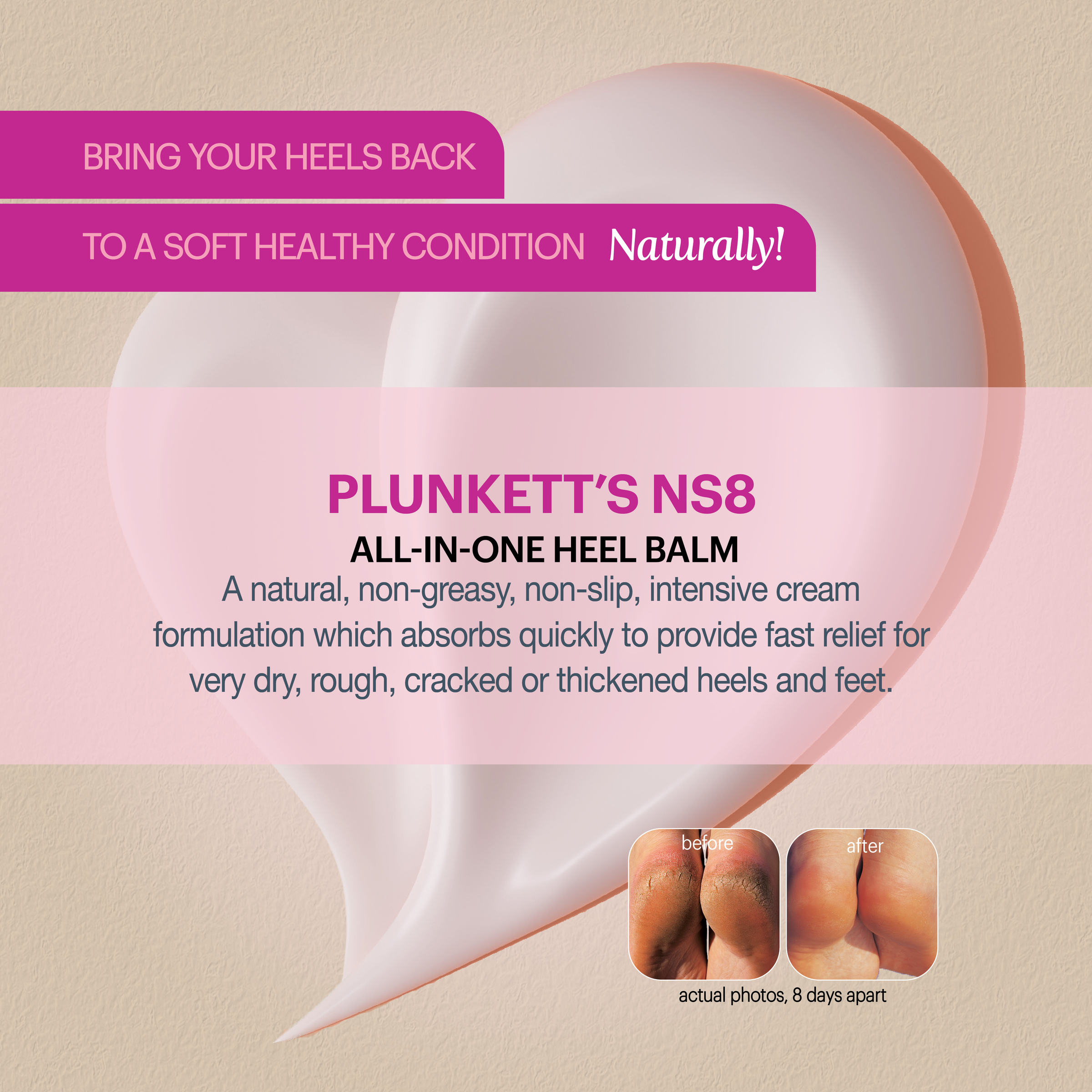 Plunkett's NS8 Heel Balm Complex 125ml - Image 4