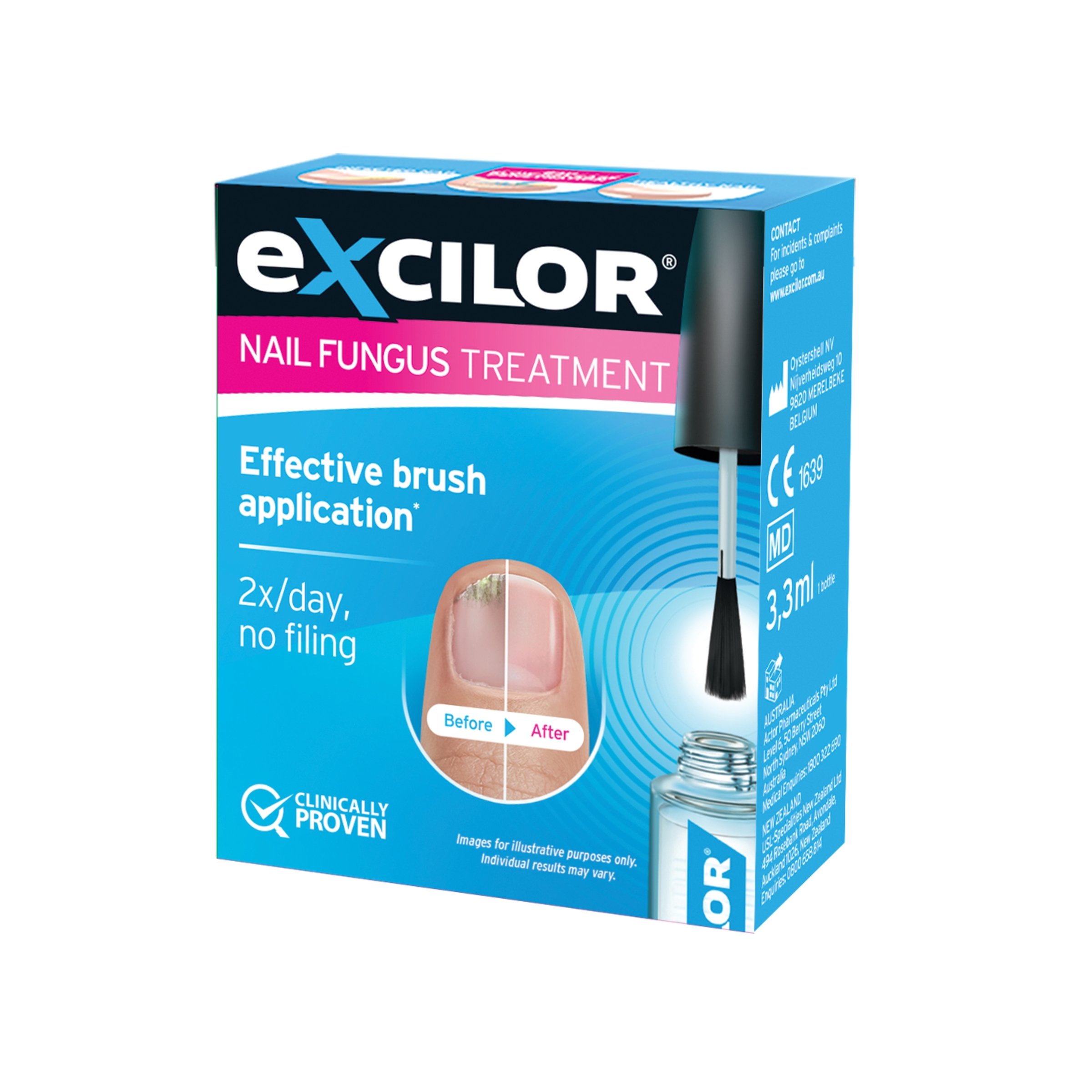 Excilor Nail Fungus Treatment Solution 3.3ml - Image 9