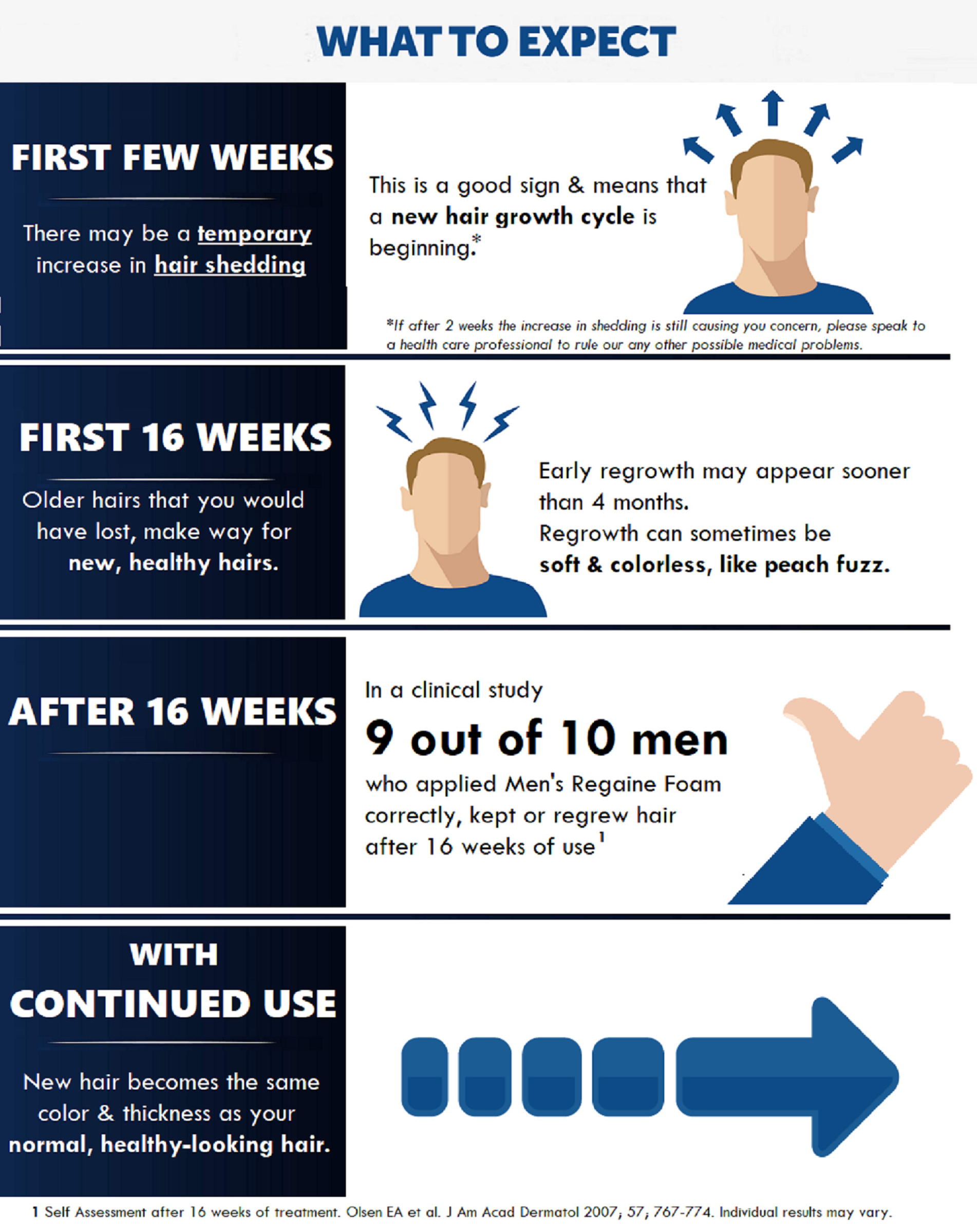 Regaine Men's Extra Strength Foam 4 Months Supply 240g - Image 8