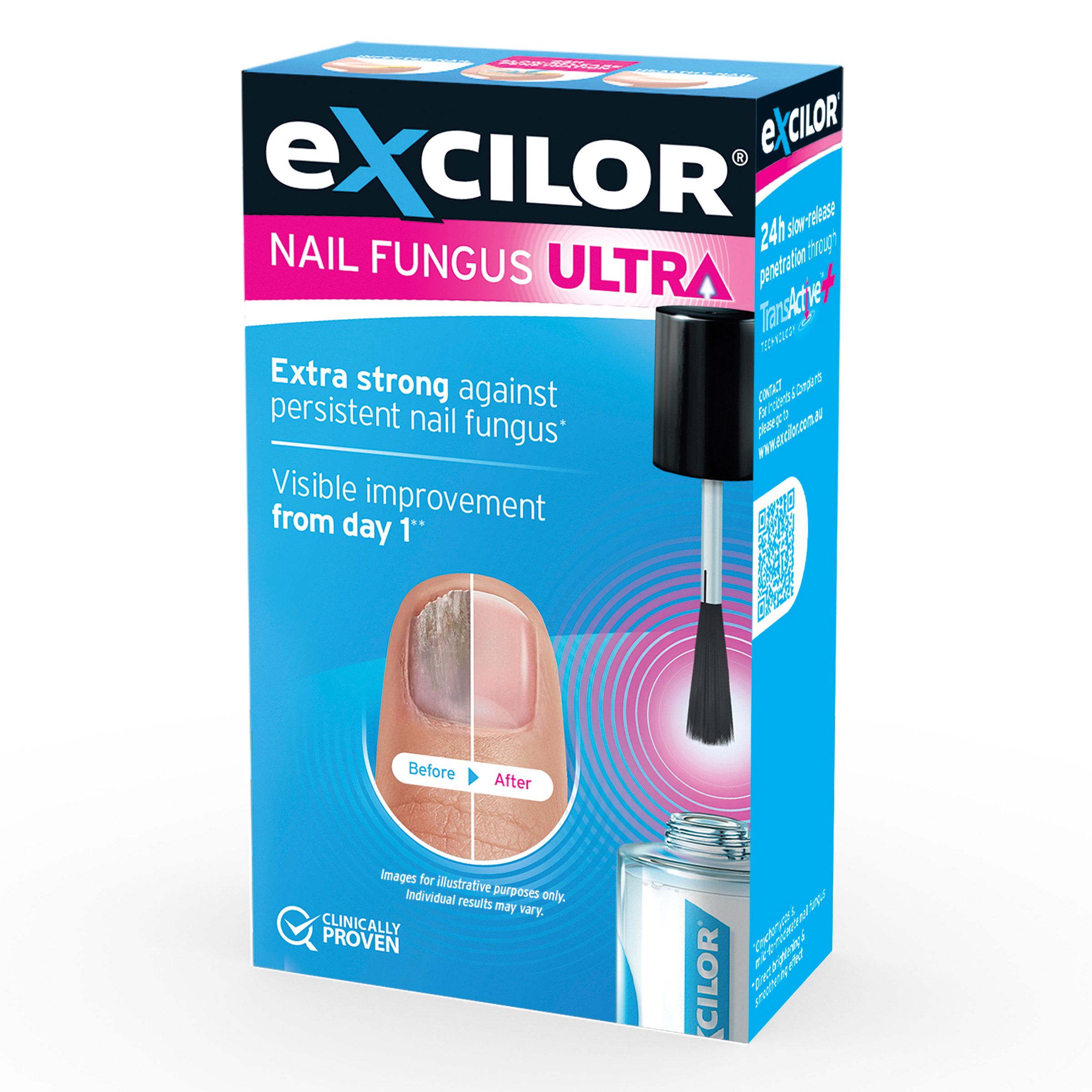 Excilor Ultra Fungal Nail Treatment 30ml - Image 6