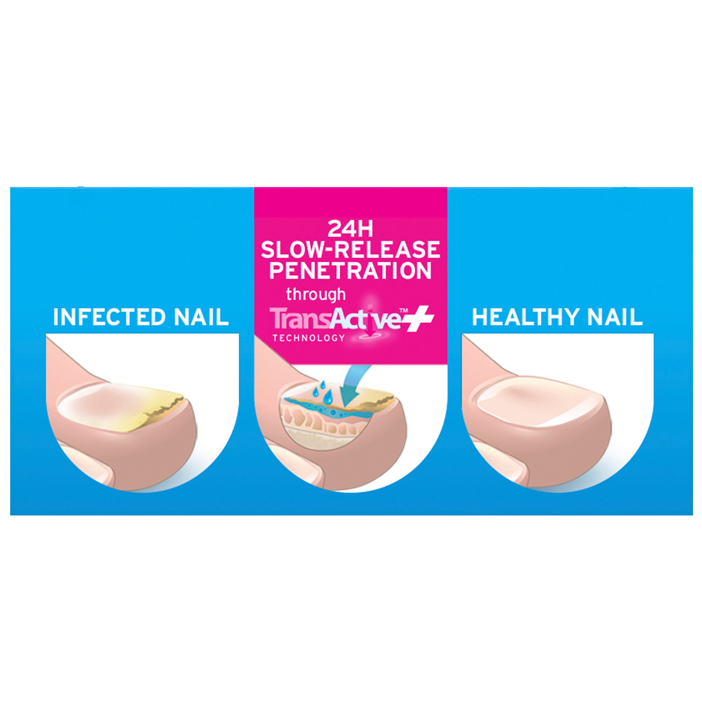 Excilor Ultra Fungal Nail Treatment 30ml - Image 5