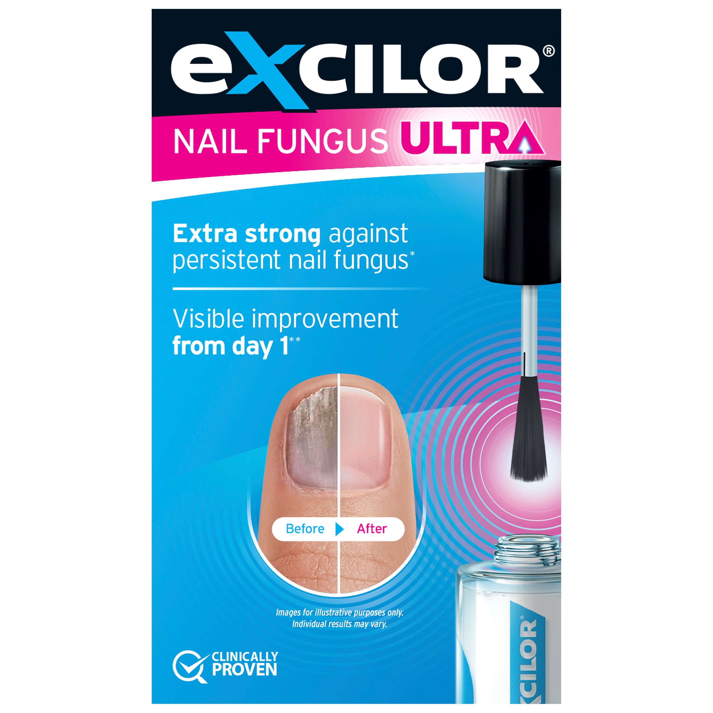 Excilor Ultra Fungal Nail Treatment 30ml - Image 1