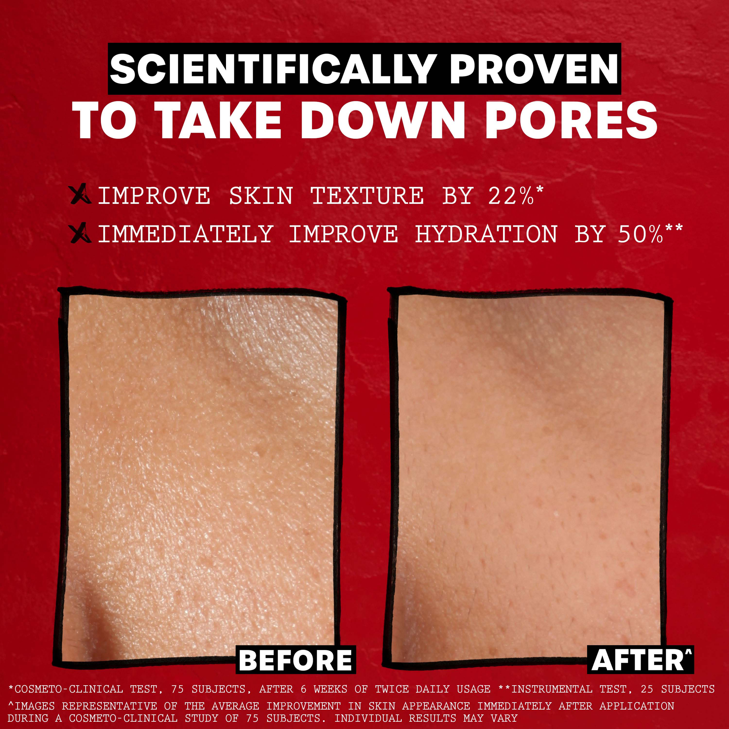 Thayers Rose Petal Alcohol-Free Toner With Witch Hazel Aloe Vera 355ml - Image 5
