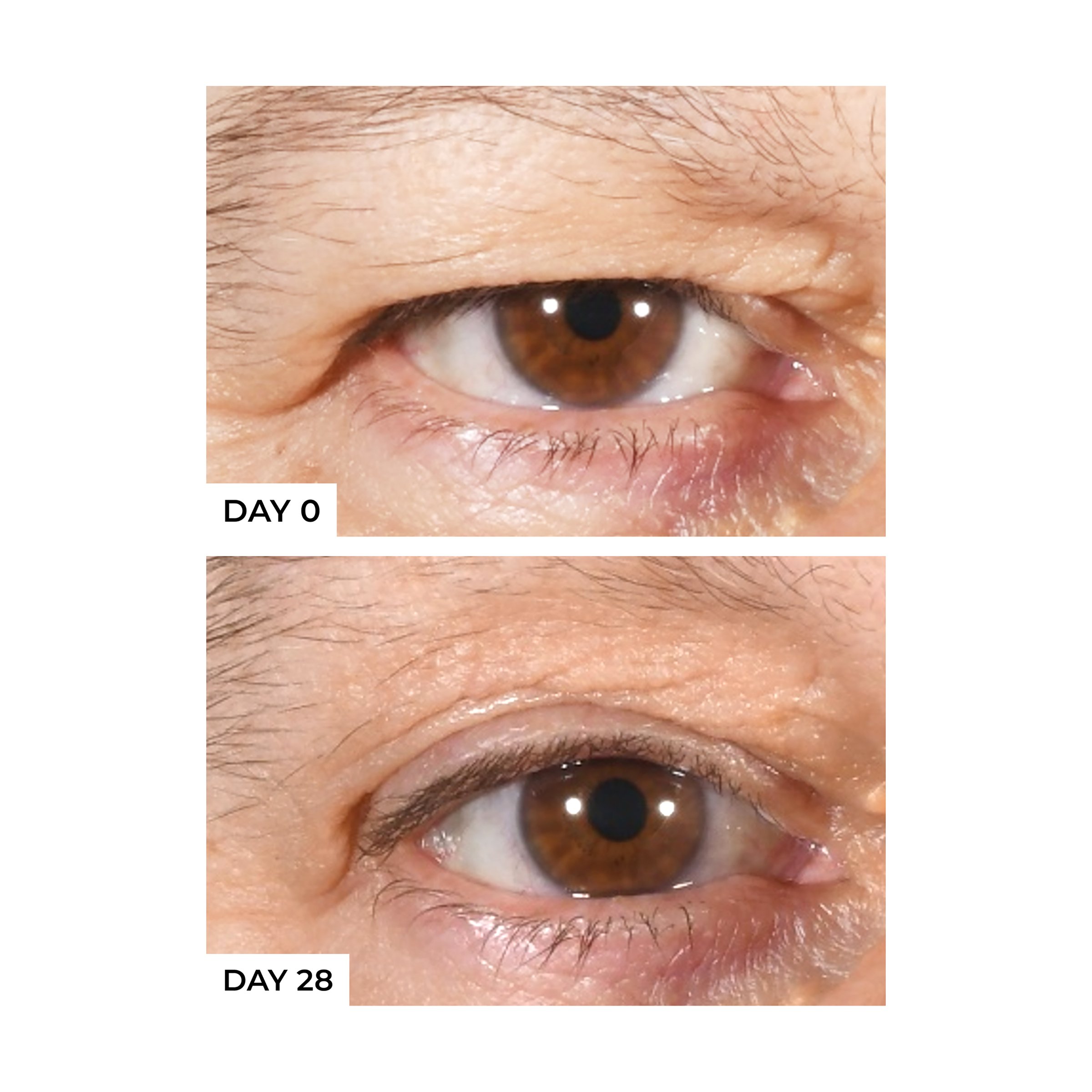 freezeframe Non Surgical Eyelid Lift 15ml - Image 2