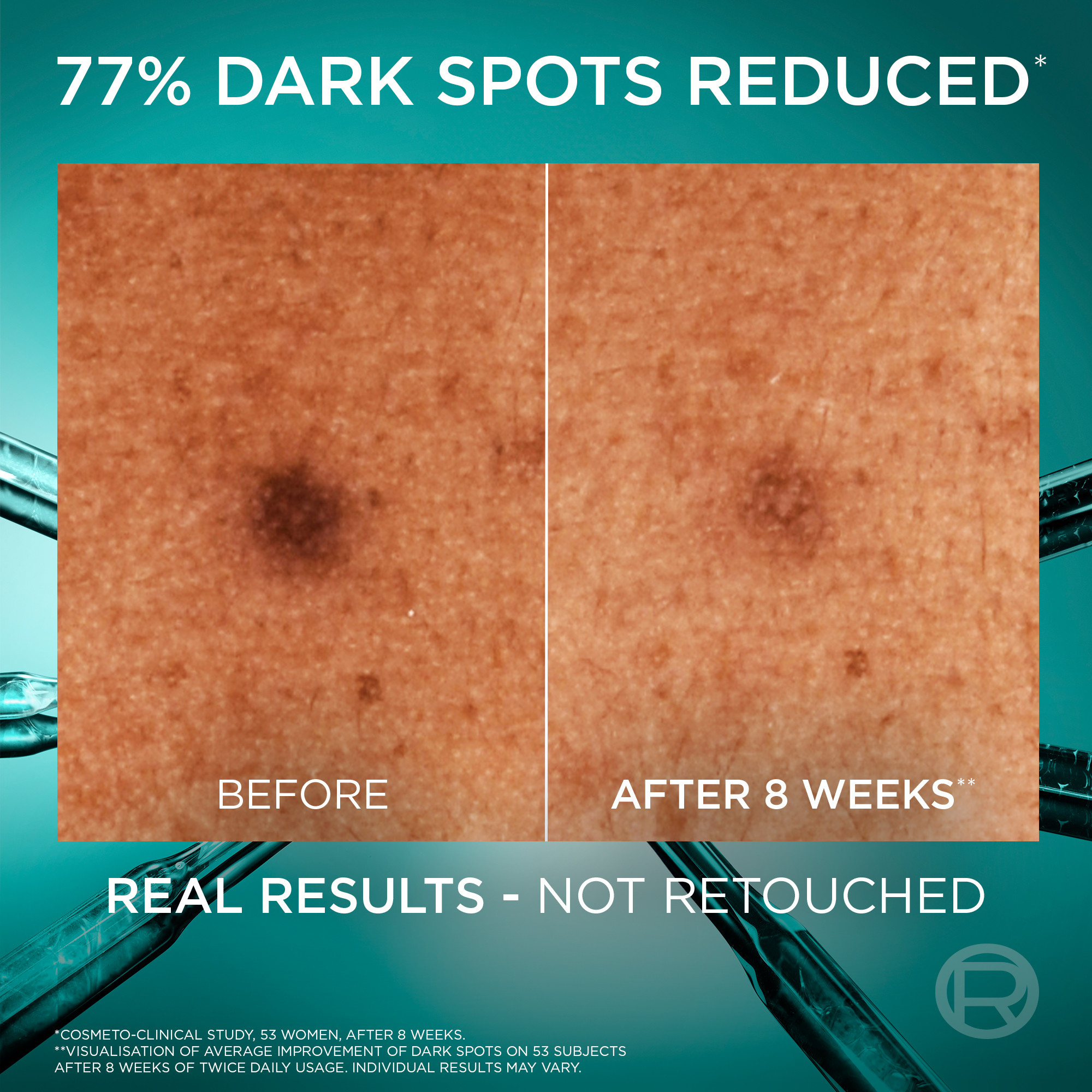 L'Oreal Paris Bright Reveal Dark Spot Serum 30ml - Image 3