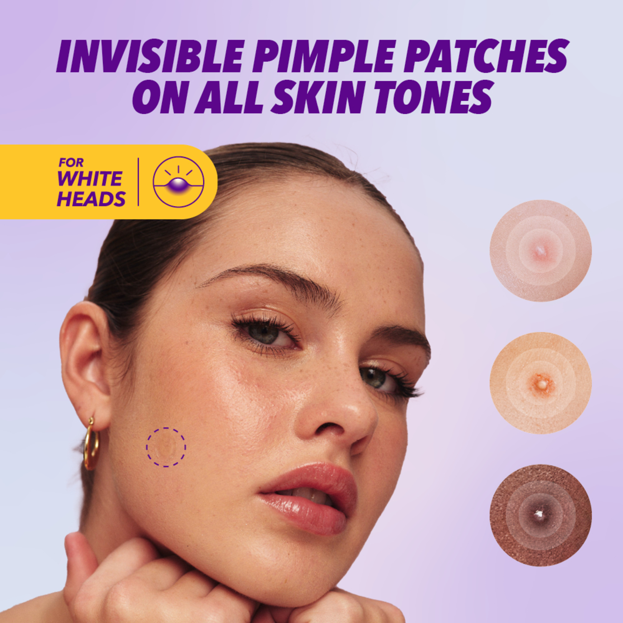 Benzac Power Patches Skin Restore 23 - 1 unit - Image 10