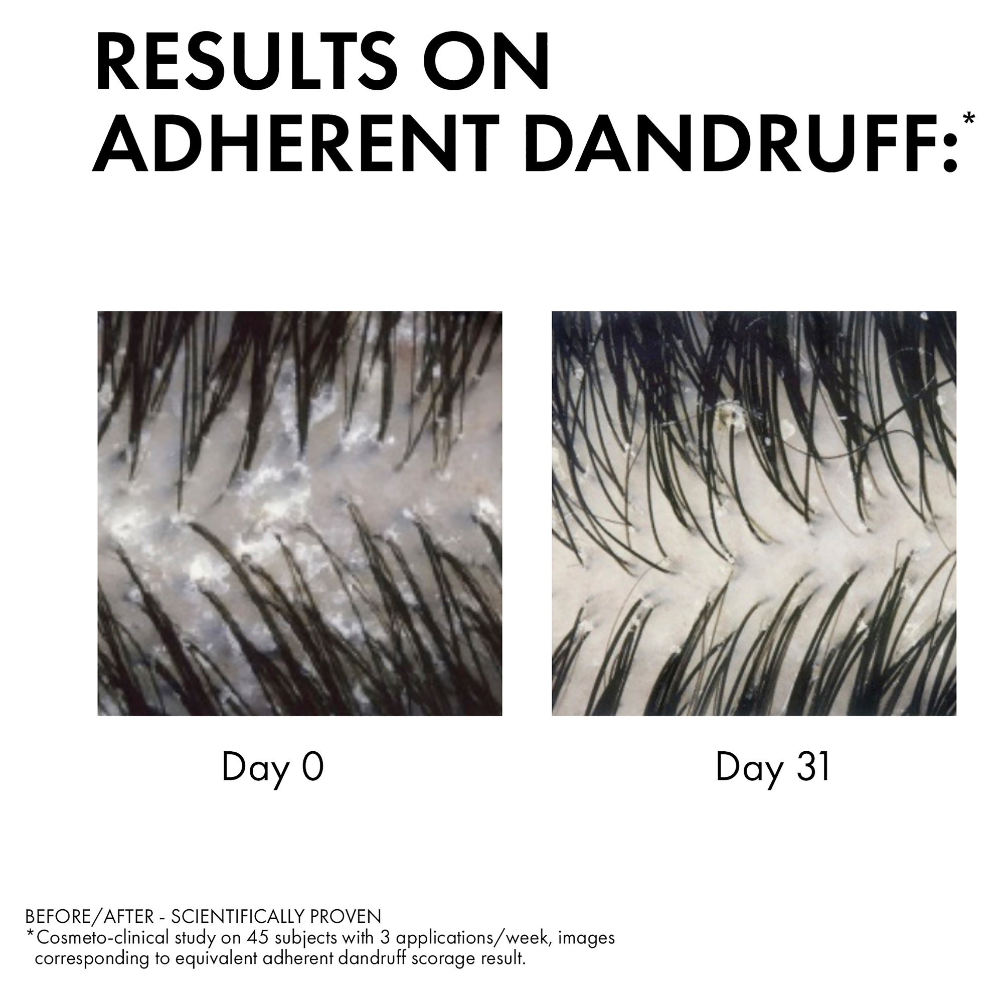 Dercos Anti-Dandruff Dandruff Shampoo Dry Hair 200ml - Image 5