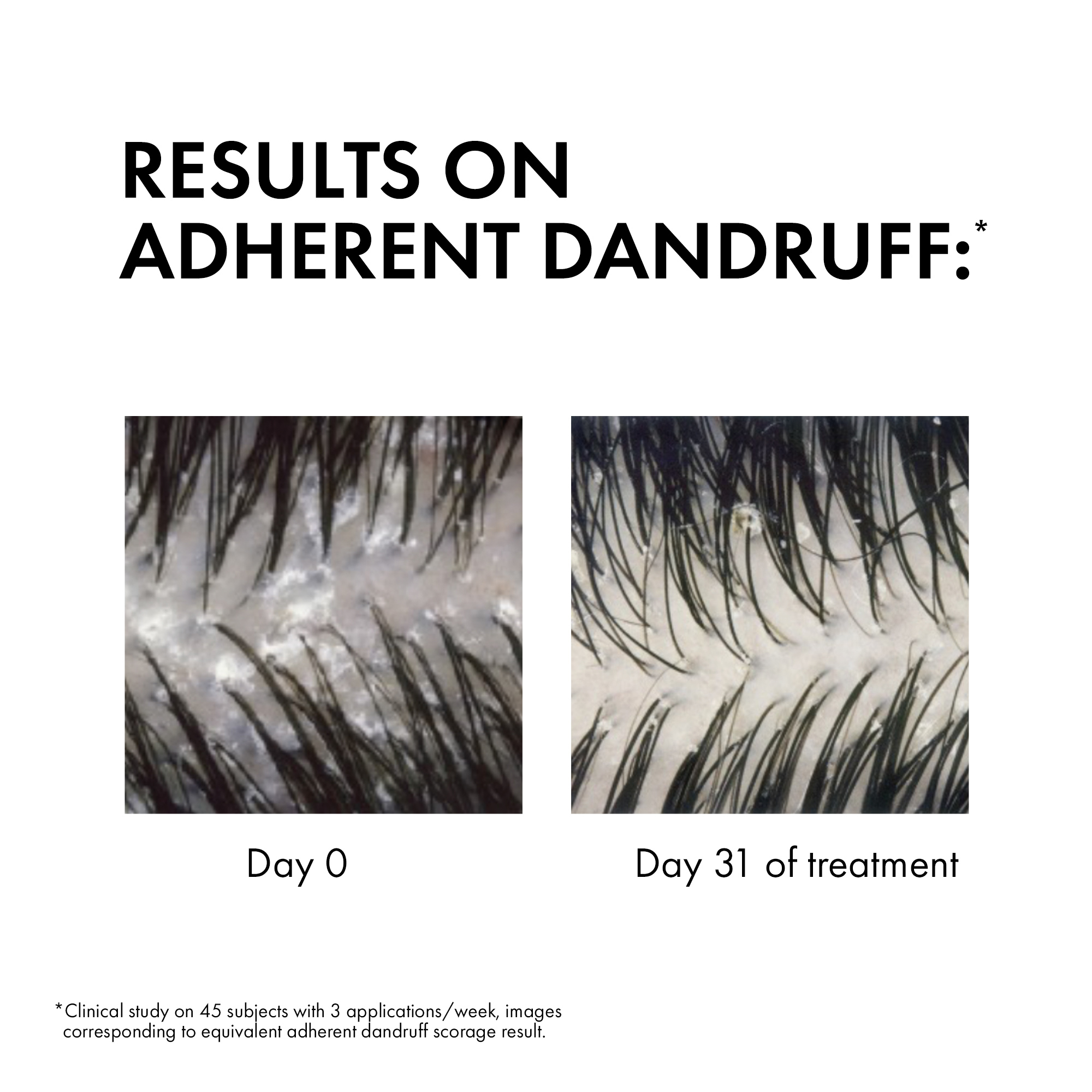 Dercos Anti-Dandruff Dandruff Shampoo - Dry Hair 390ml - Image 5