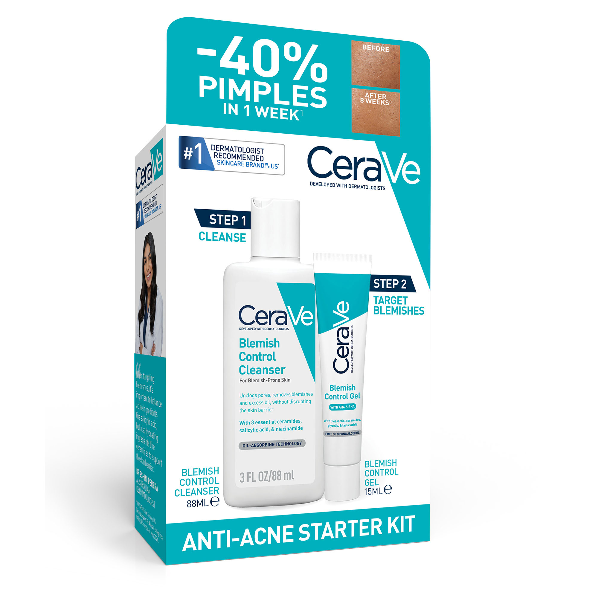 CeraVe Anti-Acne Starter 1 kit - Image 1