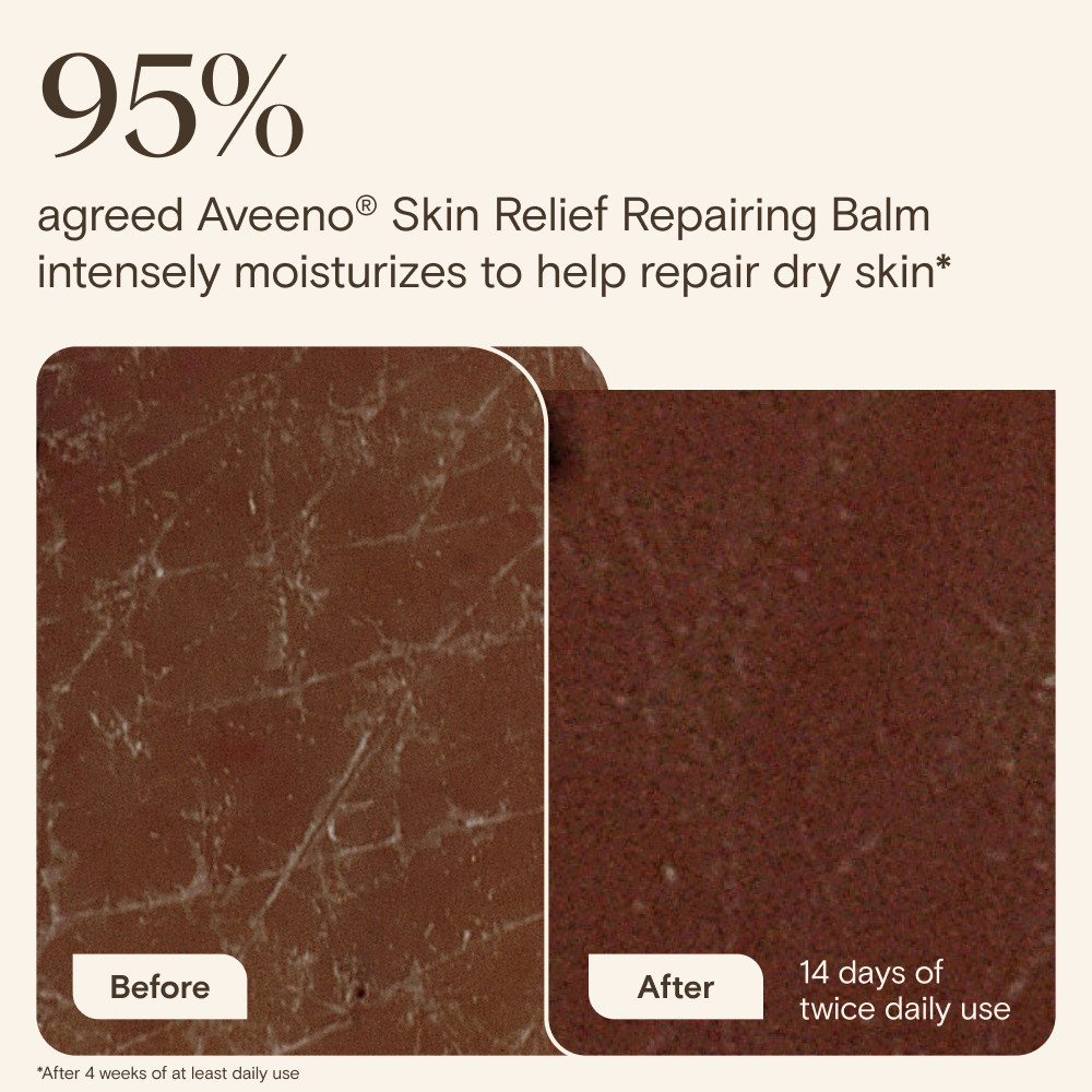 Aveeno Skin Relief Repairing Balm 75ml - Image 6