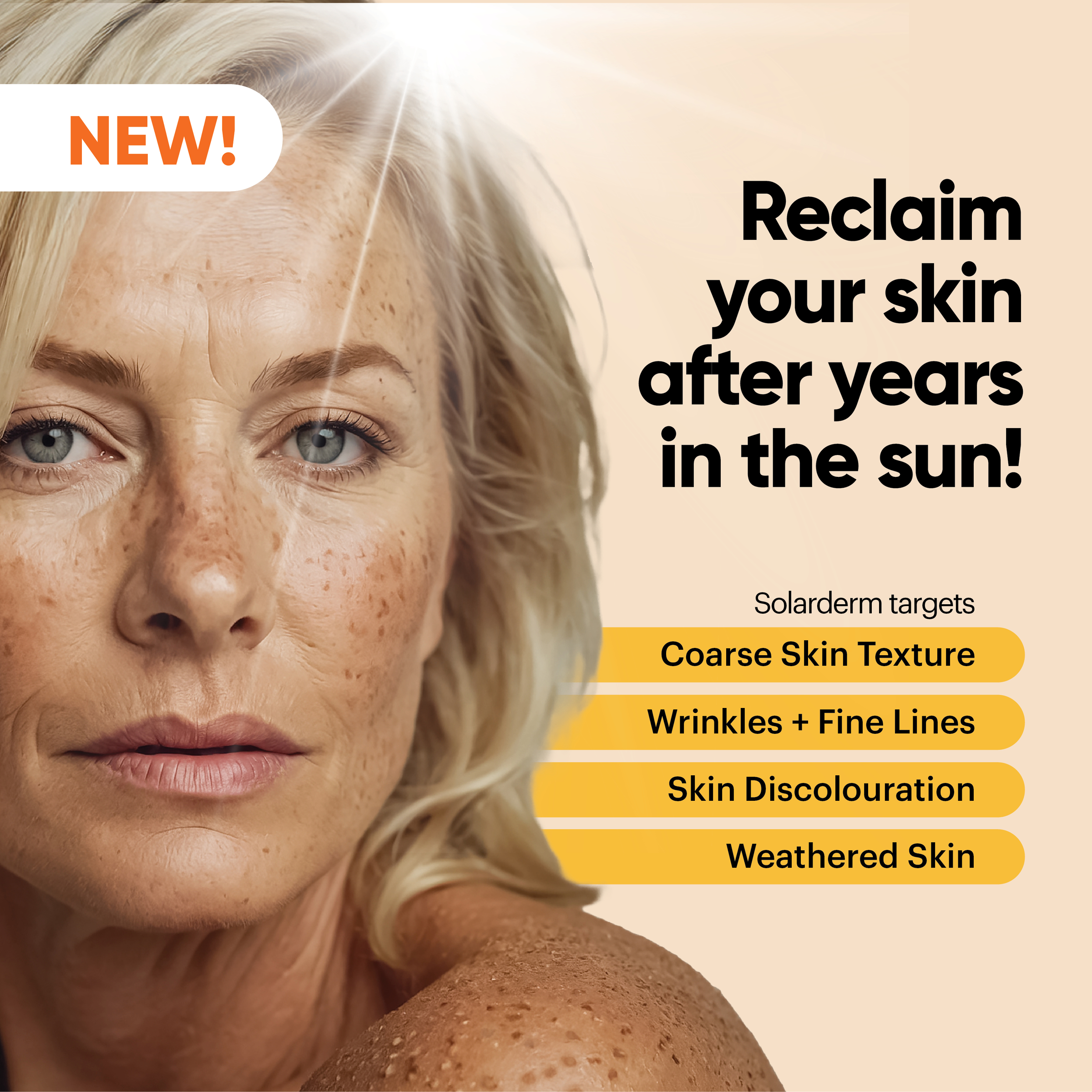 John Plunkett's Solarderm Face & Body Recovery Cream 85ml - Image 3